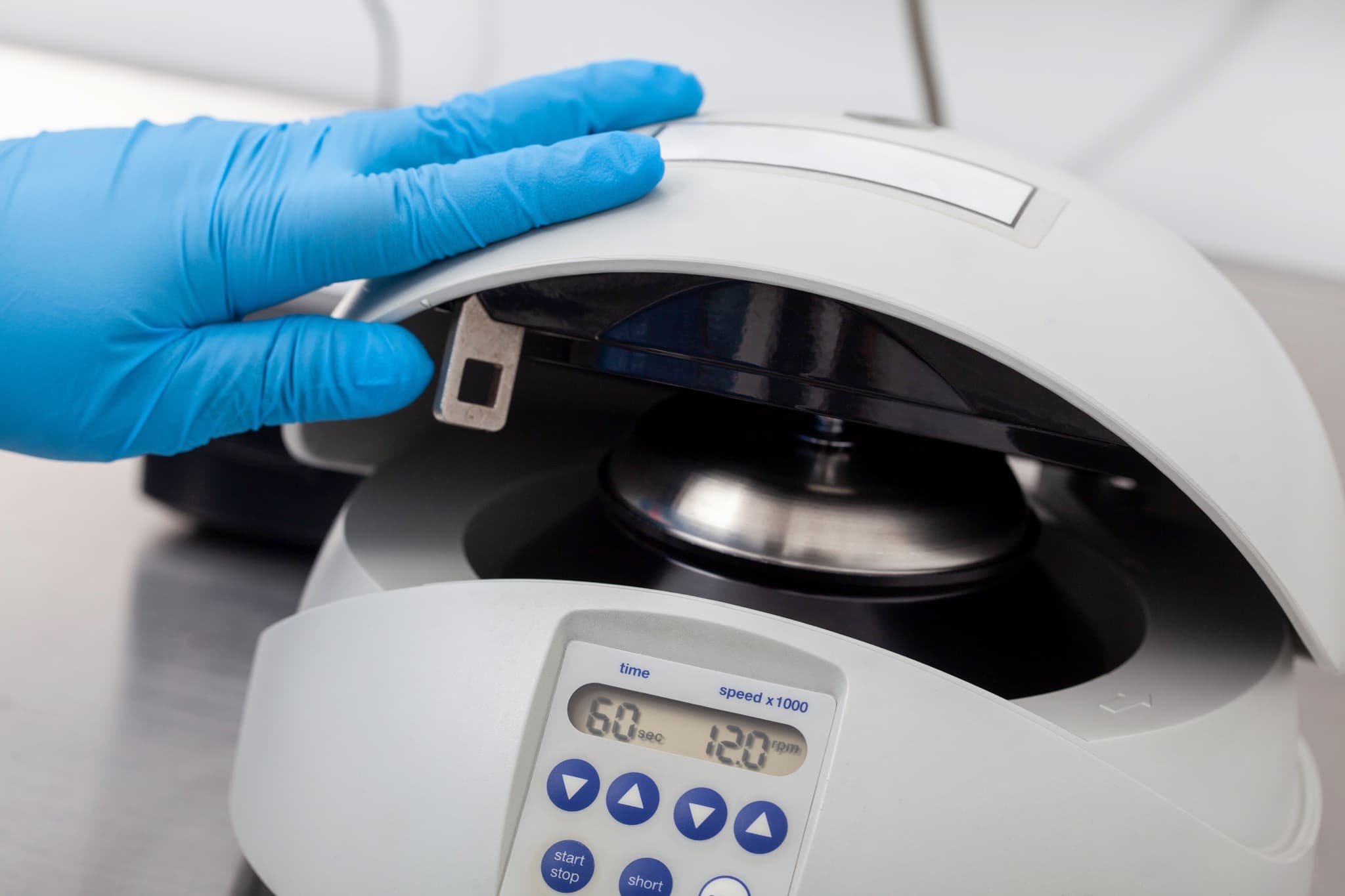 PRF (Platelet-Rich Fibrin)
