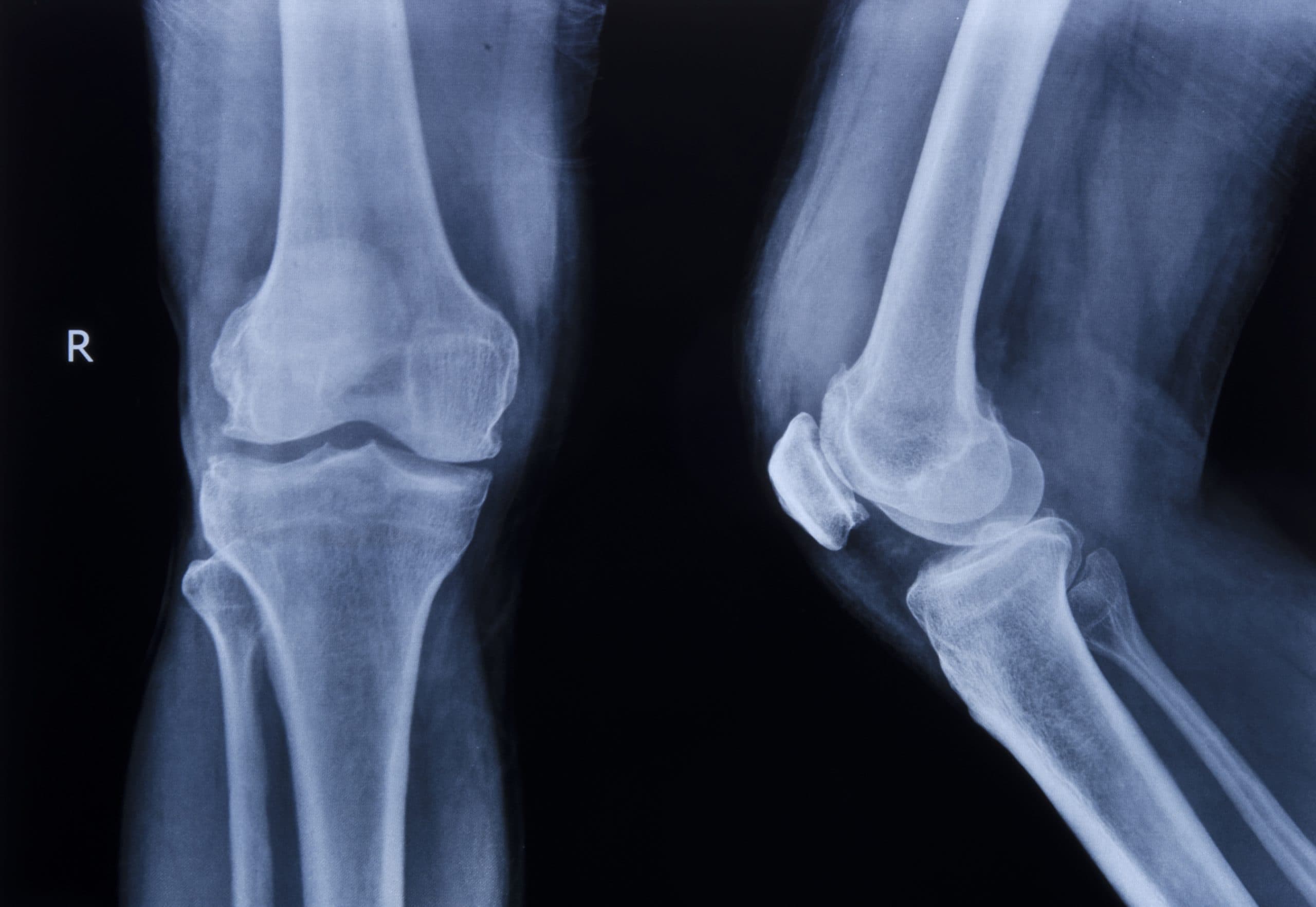 Trauma and fracture surgery, Professor Paul Lee